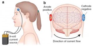 tdcs